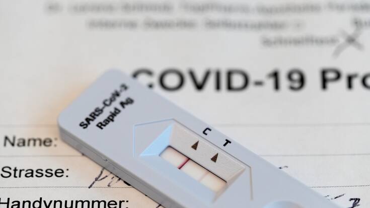 SCHWEIZ ZUERICH APOTHEKE CORONAVIRUS SCHNELLTEST
