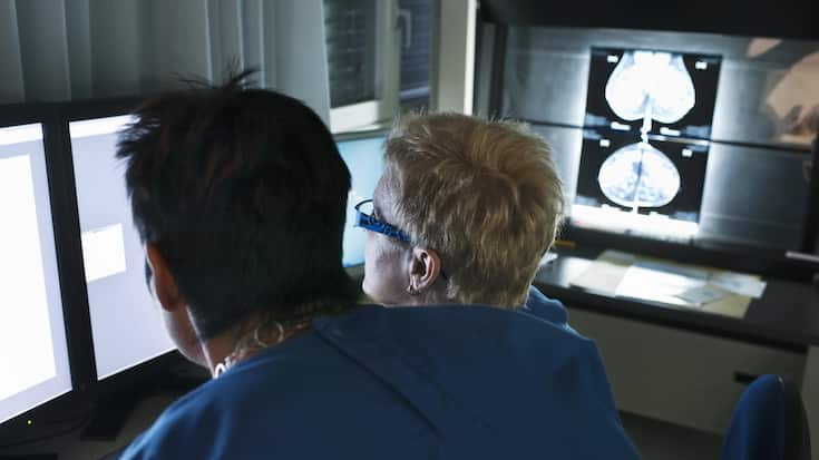 SCHWEIZ MAMMOGRAFIE, KI Bilderkennung