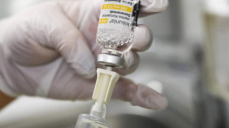 Antikörper-Medikament Donanemab