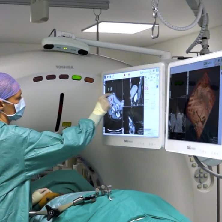 Leberkrebs Operation GPS Leberzentrum Inselspital Bern