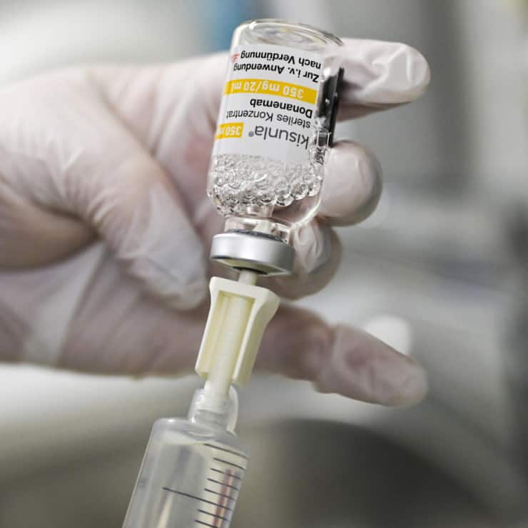 Antikörper-Medikament Donanemab