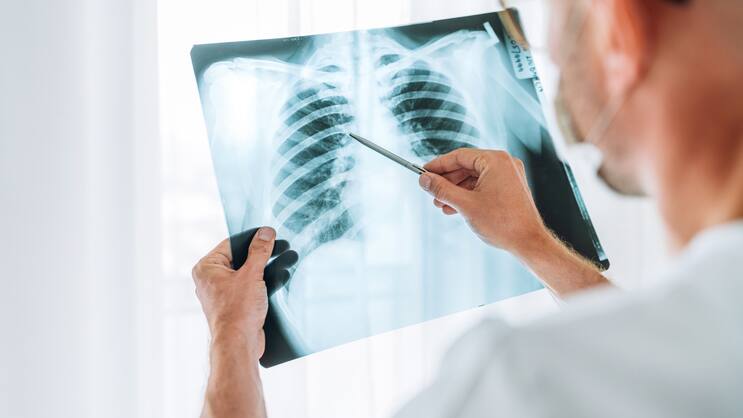 Grippe, Corona, Bronchitis: Der höchste Krankenstand seit der Wiedervereinigung durch Atemwegs- und Erkältungskrankheiten kommt der deutschen Wirtschaft einer Studie zufolge teuer zu stehen.